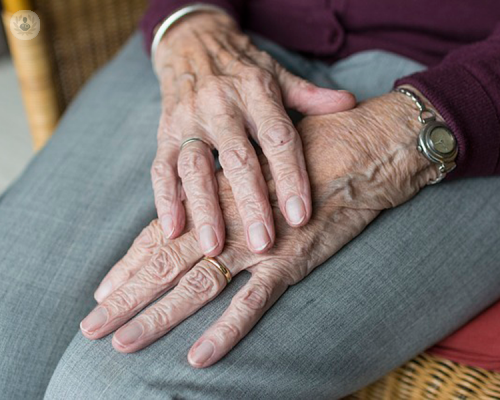 e-possibile-guarire-dall-artrite-psoriasica immagine dell'articolo