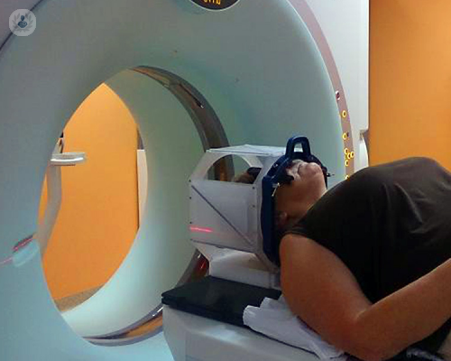 Radiochirurgia Stereotassica per curare gli Angiomi Cavernosi Cerebrali