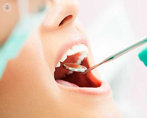 denti-del-giudizio-inclusi-eruzione-e-igiene-orale immagine dell'articolo