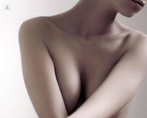 protesi-mammarie-quali-scelgo immagine dell'articolo