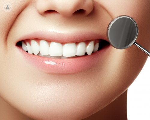Conosci i vantaggi dell’implantologia dentaria?