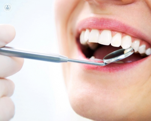 denti-del-giudizio-a-cosa-servono immagine dell'articolo