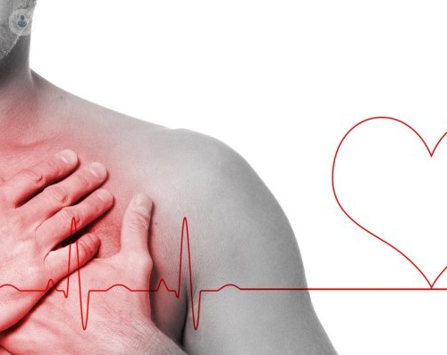 Cardiopatia ischemica: il ruolo della prevenzione cardiovascolare