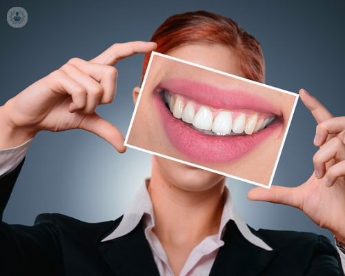 impianto-dentale-a-carico-immediato-di-cosa-si-tratta immagine dell'articolo