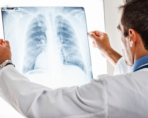 Ecografia polmonare e prelievo: diagnosi precoce COVID-19 