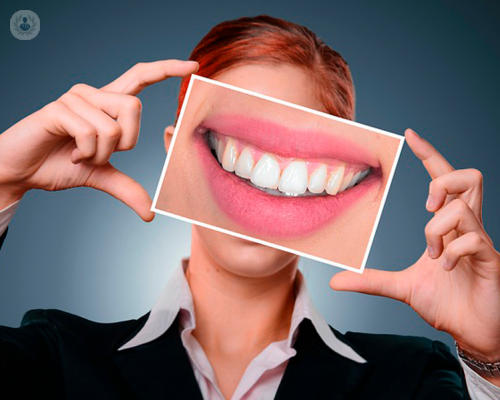 differenze-tra-lo-sbiancamento-dentale-professionale-e-quello-casalingo-fai-da-te immagine dell'articolo