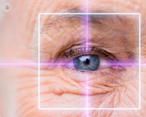 perche-il-glaucoma-e-considerato-il-killer-silente-della-vista immagine dell'articolo