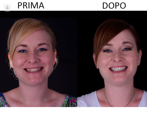 estetica-dentale-prenditi-cura-del-tuo-sorriso immagine dell'articolo