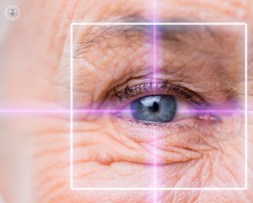 patologie-della-retina-i-principali-fattori-di-rischio immagine dell'articolo