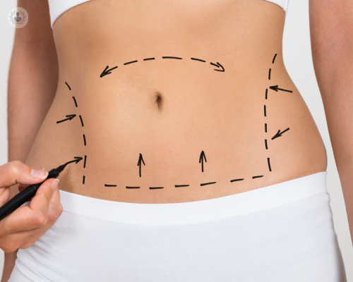 Liposuzione: una svolta per il tuo corpo!