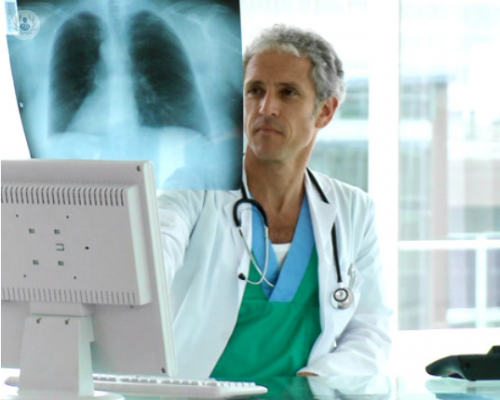 il-cancro-del-polmone-e-davvero-cosi-diffuso immagine dell'articolo