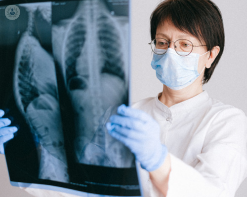 cardio-tc-la-radiologia-al-servizio-del-cuore immagine dell'articolo