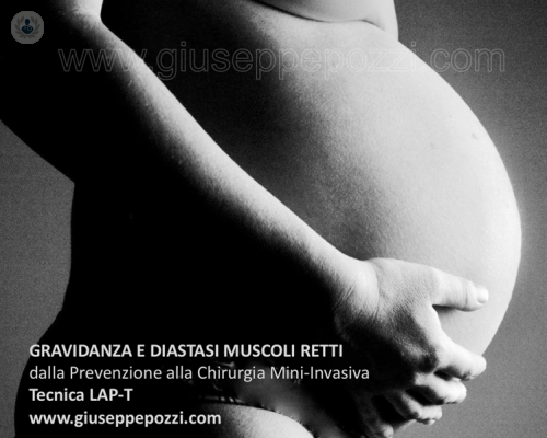 diastasi-addominale-la-soluzione-con-la-chirurgia-mininvasiva immagine dell'articolo
