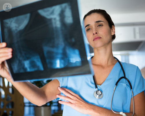 uno-dei-tumori-primitivi-l-osteosarcoma immagine dell'articolo