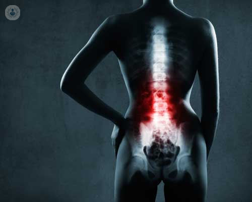 Le malattie degenerative della colonna vertebrale: cause, diagnosi e trattamento