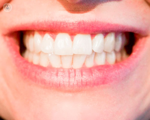 i-denti-una-possibile-causa-del-mal-di-schiena-o-del-mal-di-testa immagine dell'articolo