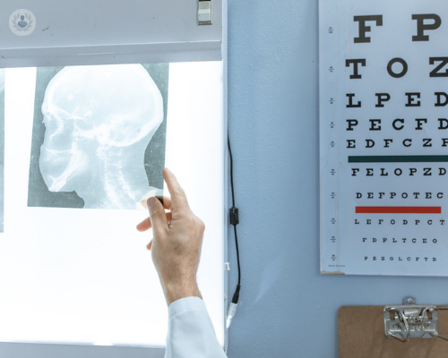 fistole-artero-venose-durali-diagnosi-e-terapia immagine dell'articolo