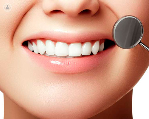 estetica-dentale-come-migliorare-il-nostro-sorriso immagine dell'articolo