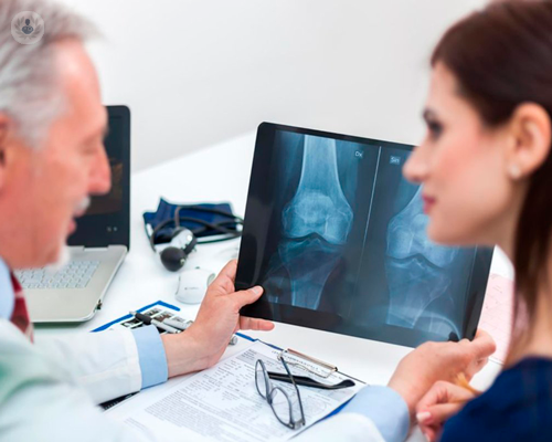 ablazione-di-neoformazioni-ossee-od-osteoarticolari immagine dell'articolo
