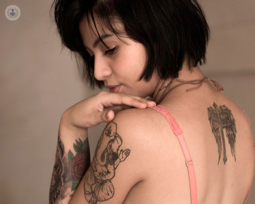 rimozione-di-tatuaggi-con-laser-tutto-cio-che-c-e-da-sapere immagine dell'articolo