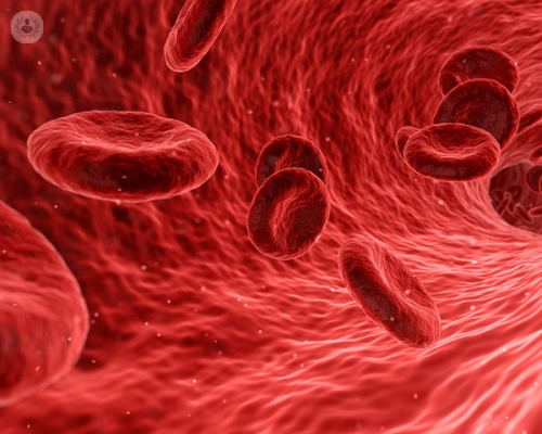 litotrissia-coronarica-una-tecnica-all-avanguardia immagine dell'articolo