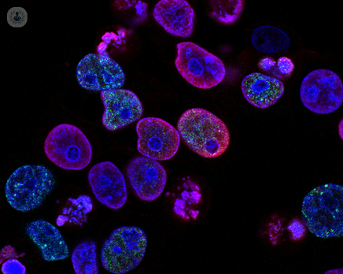 antigene-prostatico-specifico-il-punto-di-vista-dello-specialista-nella-pratica-urologica immagine dell'articolo