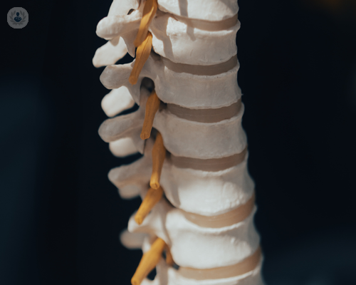 vertebroplastica-in-cosa-consiste immagine dell'articolo