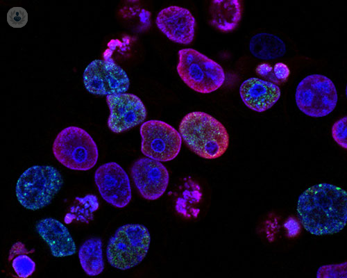malattie-autoimmuni-di-che-cosa-si-tratta immagine dell'articolo