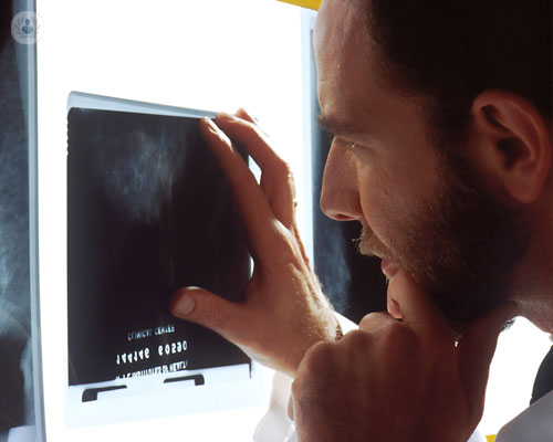 tumore-della-prostata-il-tumore-piu-diffuso-negli-uomini immagine dell'articolo