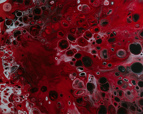 nuovo-interesse-per-le-malattie-delle-vene-e-delle-arterie immagine dell'articolo