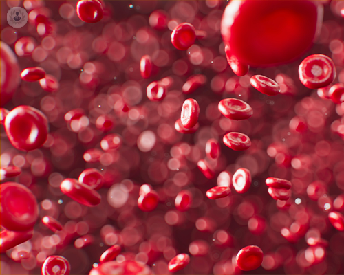 arteriopatie-e-stenosi-vediamole-insieme immagine dell'articolo