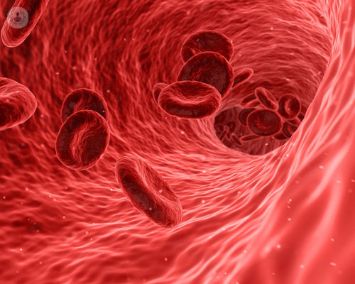 le-vasculiti-dei-piccoli-vasi immagine dell'articolo