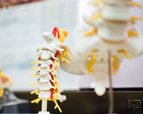 Chirurgia endoscopica spinale: come funziona?