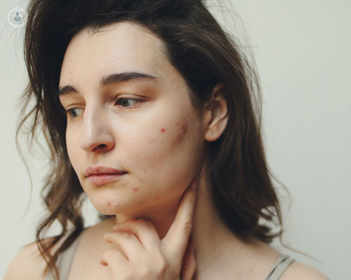luce-pulsata-utilizzi-funzionamento-e-benefici-in-estetica-e-dermatologia immagine dell'articolo