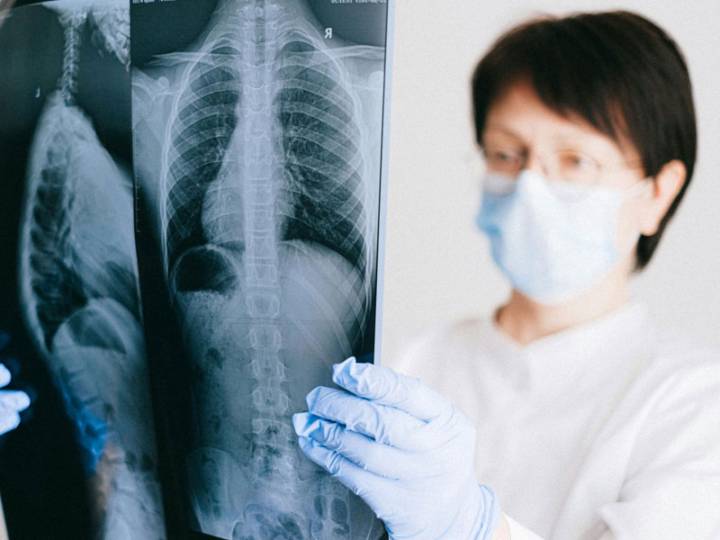 enfisema-polmonare-cause-e-sintomi immagine dell'articolo