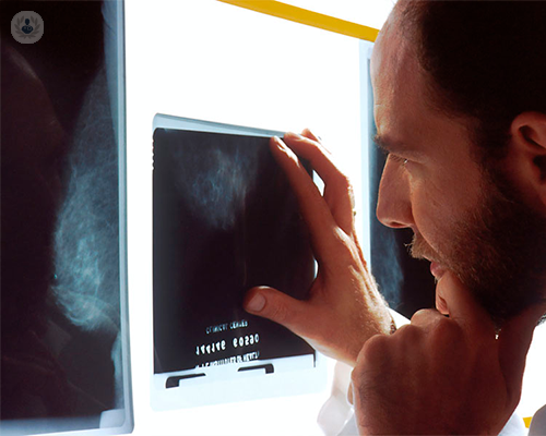 vantaggi-del-trattamento-gamma-knife-nei-meningiomi-atipici immagine dell'articolo
