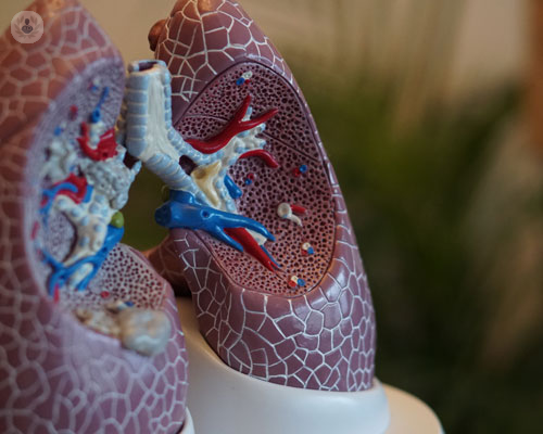 mesotelioma-pleurico-cause-sintomi-e-trattamenti immagine dell'articolo