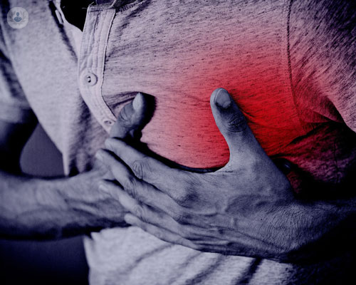 breve-guida-alla-cardiopatia-ischemica immagine dell'articolo