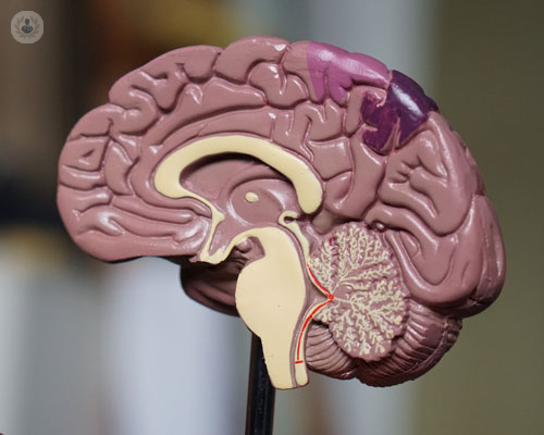 il-meningioma-piccola-guida immagine dell'articolo