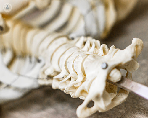 cifoplastica-una-soluzione-per-le-fratture-vertebrali immagine dell'articolo