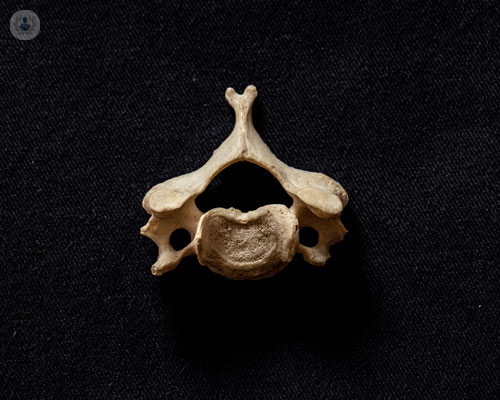 ernia-cervicale-patologia-molto-diffusa immagine dell'articolo