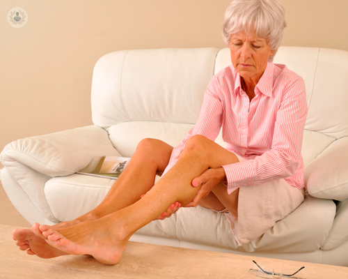 scleroterapia-una-soluzione-efficace-per-i-problemi-venosi immagine dell'articolo