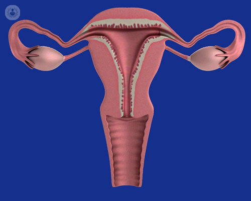 carcinoma-ovarico-cosa-c-e-da-sapere immagine dell'articolo
