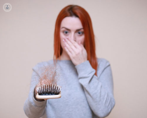 perdita-capelli-e-calvizie-cause-e-trattamenti immagine dell'articolo
