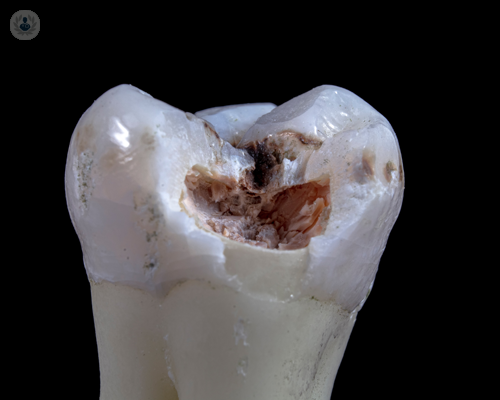 endodonzia-di-che-cosa-si-occupa immagine dell'articolo