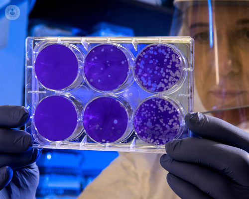 trattamento-con-cellule-staminali-in-ortopedia immagine dell'articolo