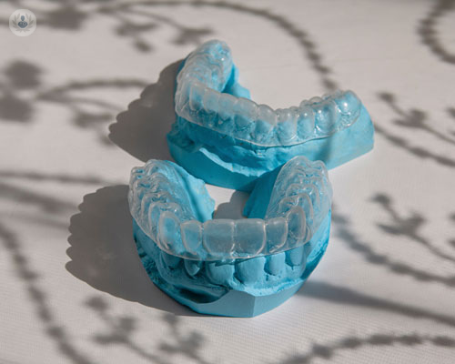 invisalign-la-soluzione-per-un-sorriso-perfetto immagine dell'articolo