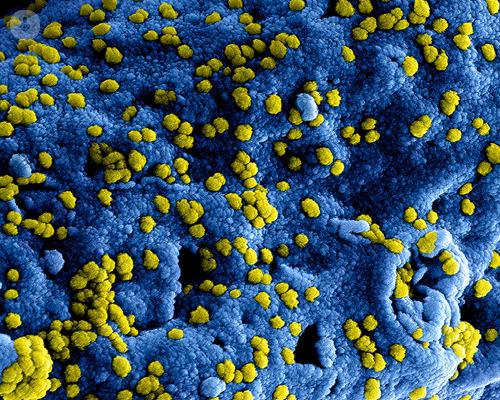 infezioni-batteriche-e-virali-ricorrenti immagine dell'articolo