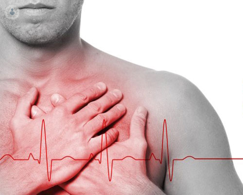 cardiopatia-ischemica-scopri-di-piu immagine dell'articolo