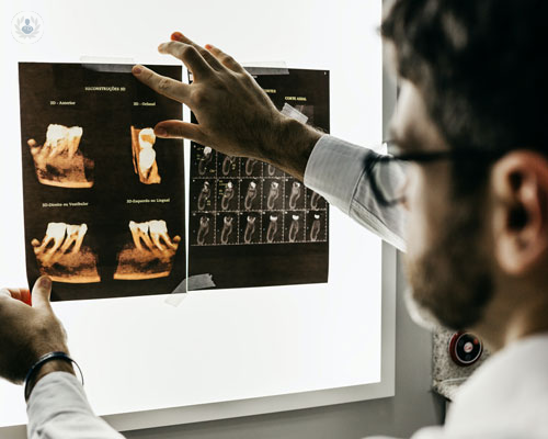 i-traumi-cranio-maxillo-facciali immagine dell'articolo